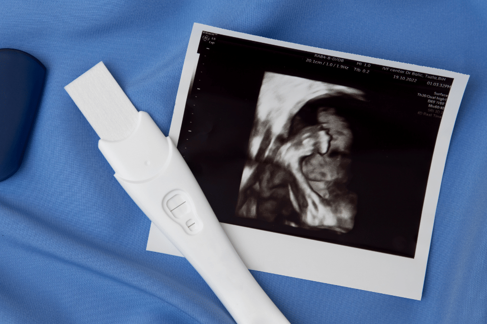 Ilustrasi gambar testpack (Freepik)