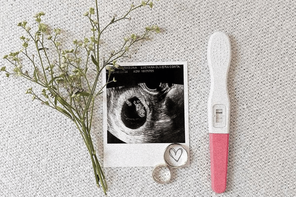 Pinterest.com/meubebesortudo