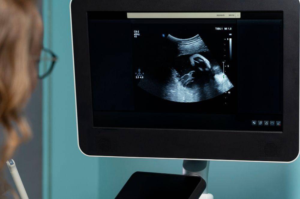 Kenali 9 Tipe Kehamilan yang Mama Wajib Tahu