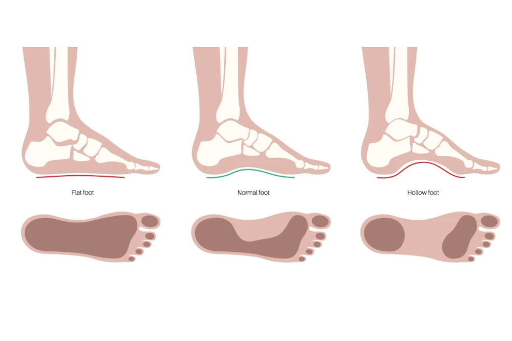 Panduan Memilih Alas Kaki Anak yang Tepat dan Nyaman