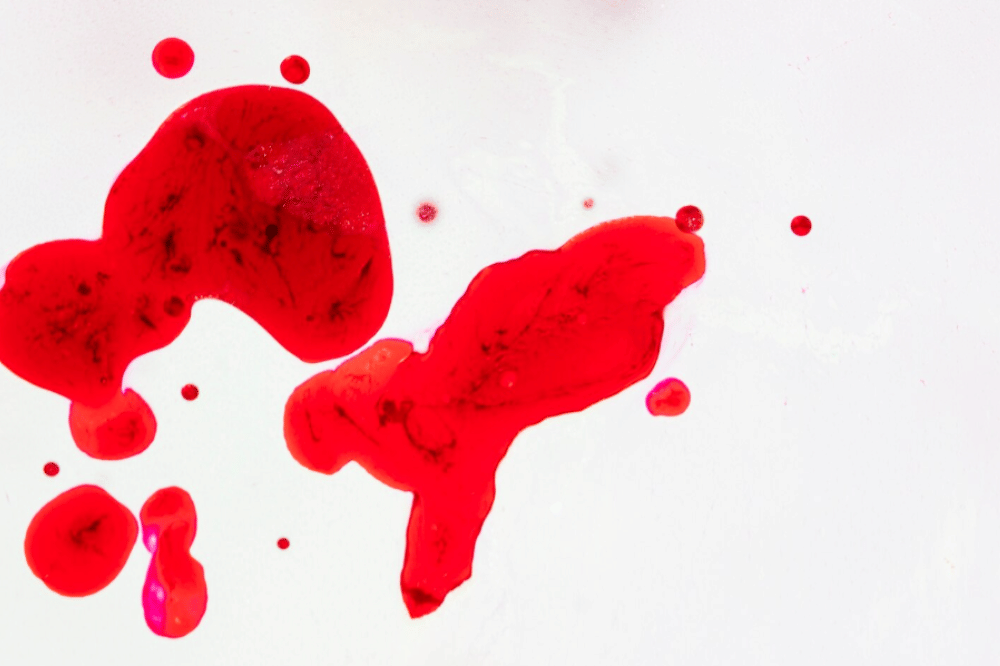 5 Gejala Kanker Paru-paru, Penyebab Acil Bimbo Meninggal 3.png