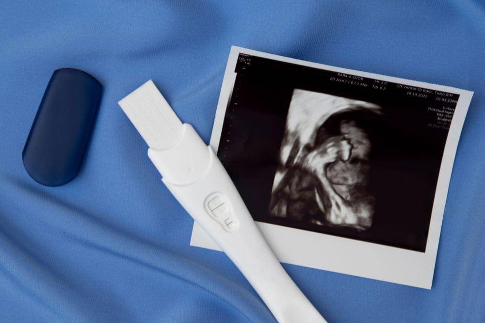 Kenali 9 Tipe Kehamilan yang Mama Wajib Tahu