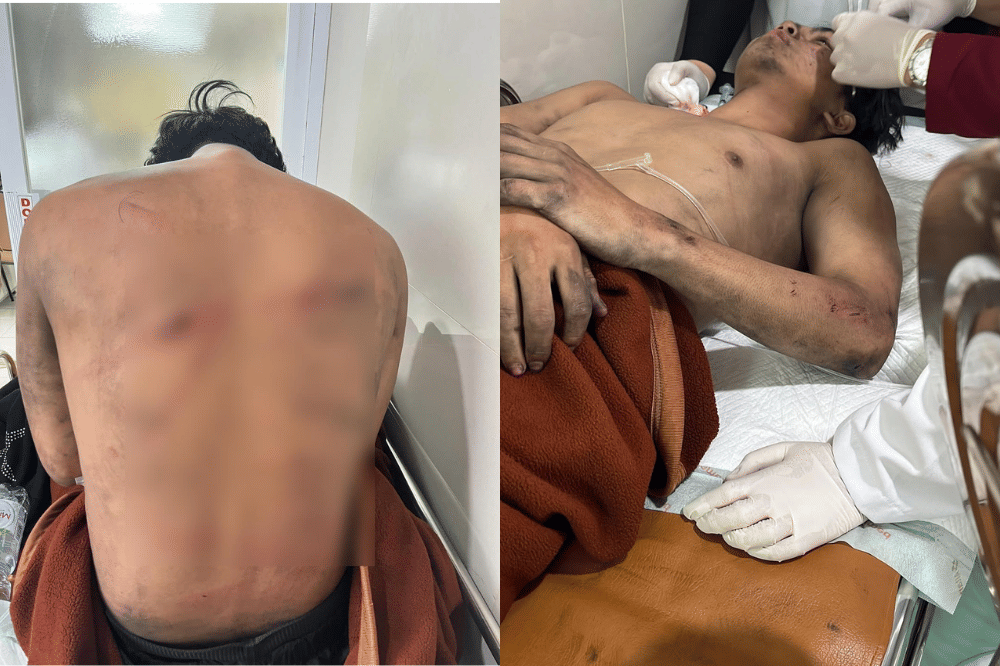 Ganindra Bimo Bantu Korban Salah Sasaran Oknum Polisi