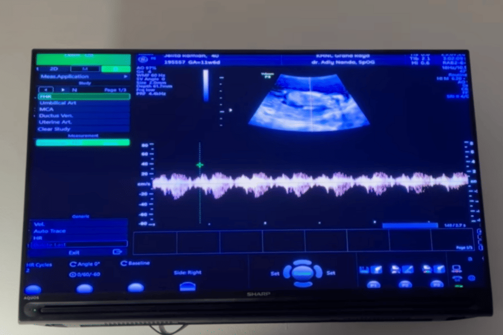 Jelita Ramlan Hamil Anak Kedua 1.png