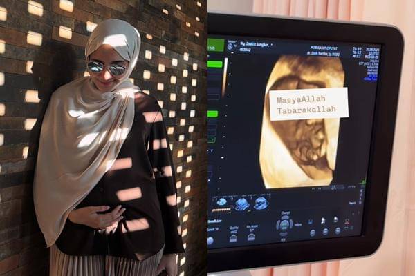 Zaskia Sungkar Umumkan Kehamilan (Instagram.com/zaskiasungkar15)