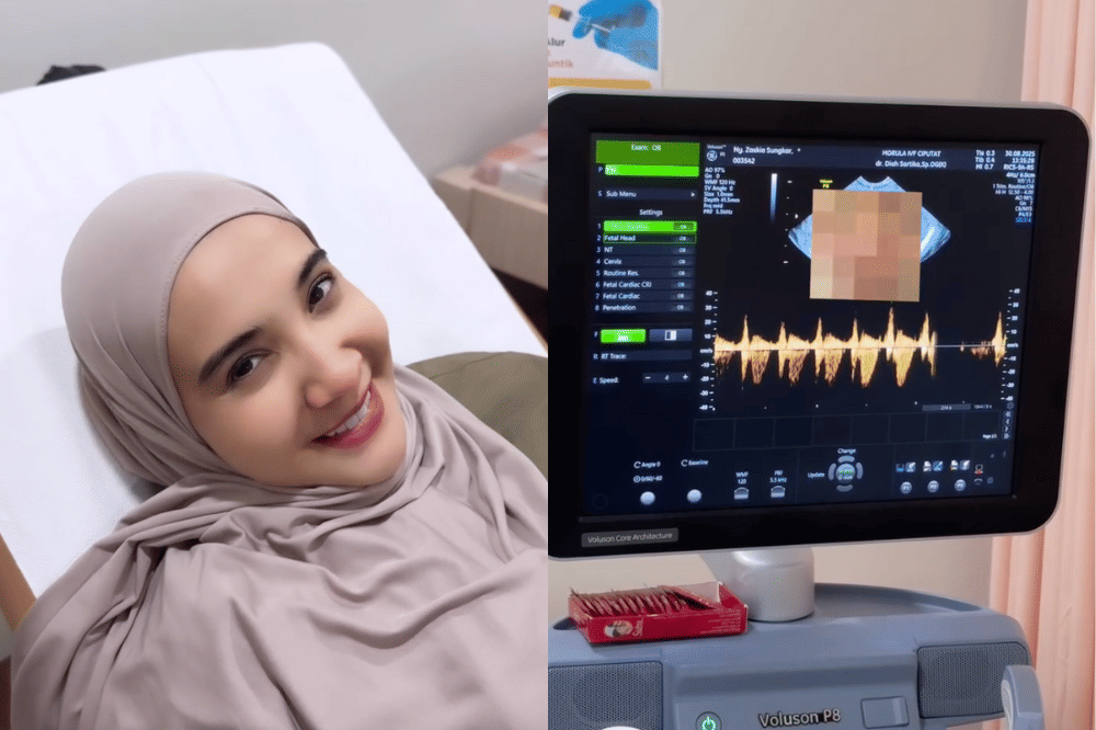 Zaskia Sungkar umumkan hamil anak kedua melalui akun Instagram.png