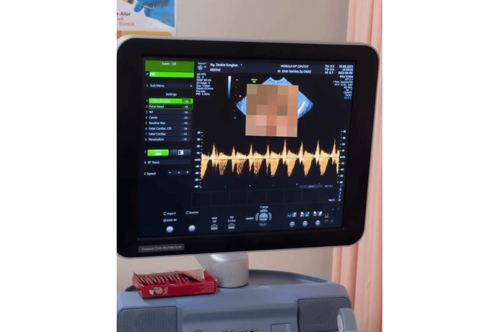 Instagram.com/zaskiasungkar15