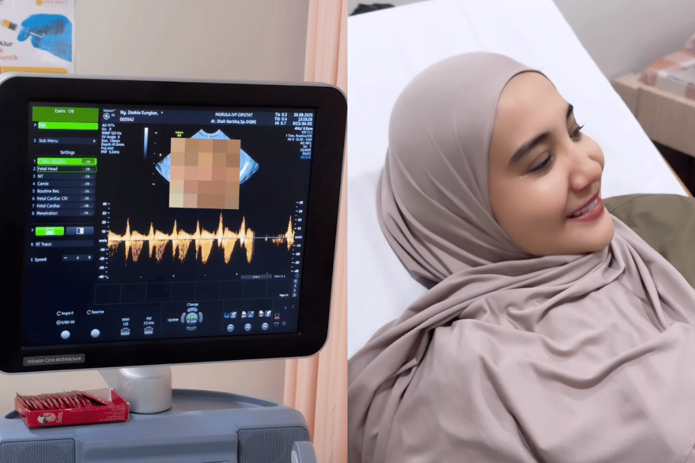 Fakta Kehamilan Kedua Zaskia Sungkar 1.png