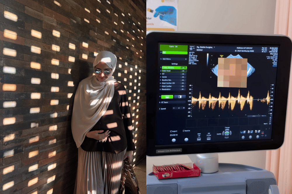 Fakta Kehamilan Kedua Zaskia Sungkar 6.png