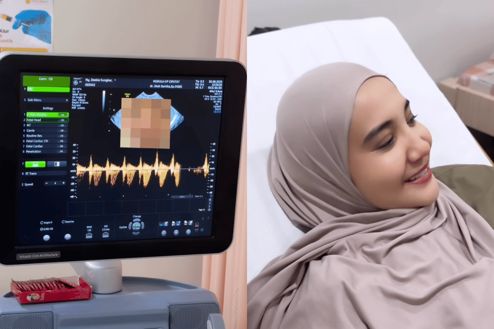 Perjuangan Zaskia Sungkar agar Bisa Hamil Anak Kedua 4.png