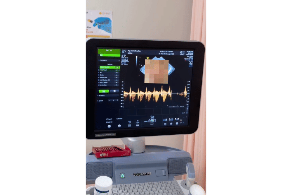 Zaskia Sungkar siap menyambut anak keduanya pada tahun 2026 mendatang.png