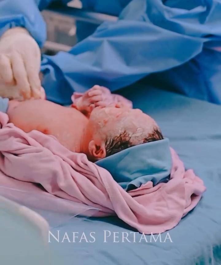 Potret Beby Istri Onad Melahirkan Anak Kedua 4.jpg