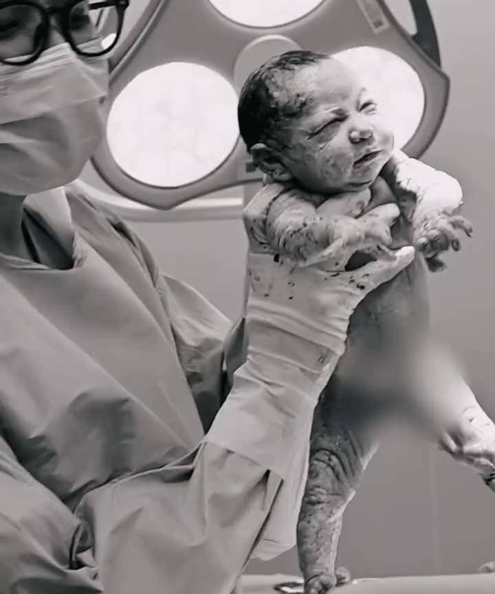 Potret Beby Istri Onad Melahirkan Anak Kedua 3.jpg