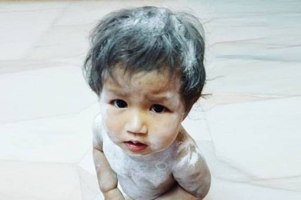 Stop Gunakan Bedak Tabur pada Anak! Ini Kata Dokter