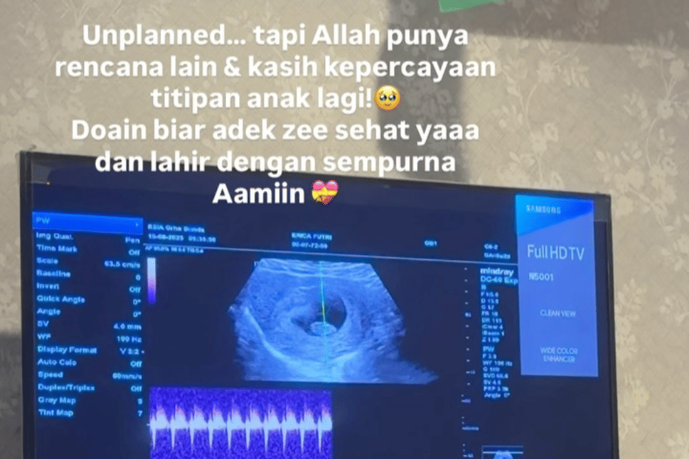 Erica Putri Sebut Hamil Anak Kedua Berkat Padel 7.png