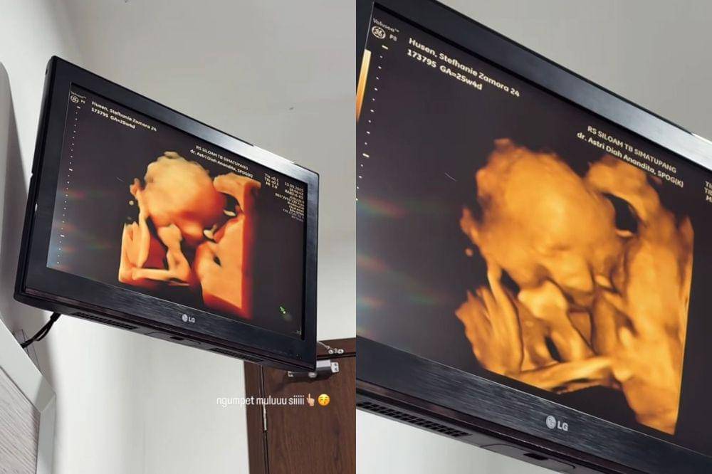 steffi zamora hamil anak pertama