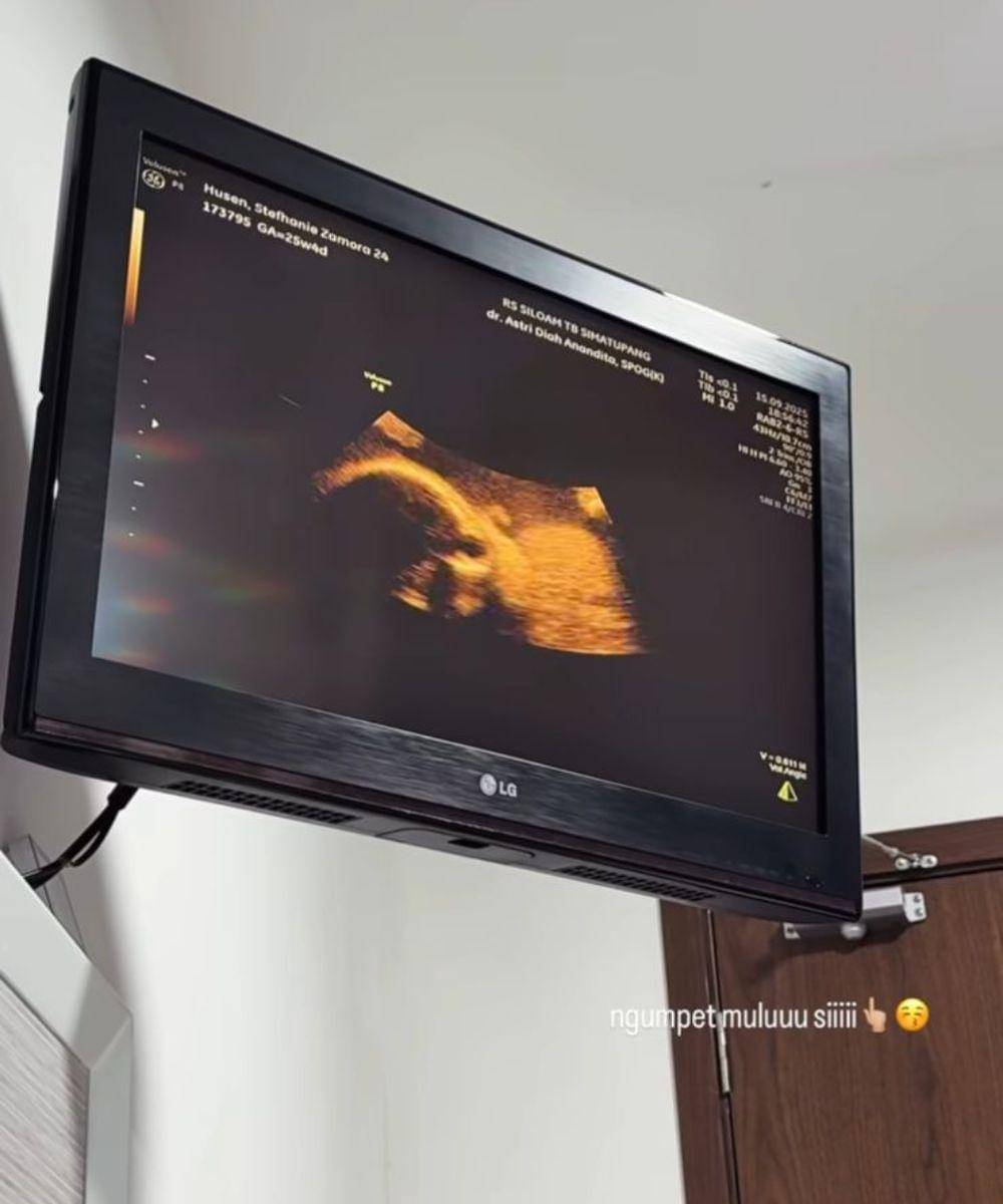 steffi zamora hamil anak pertama