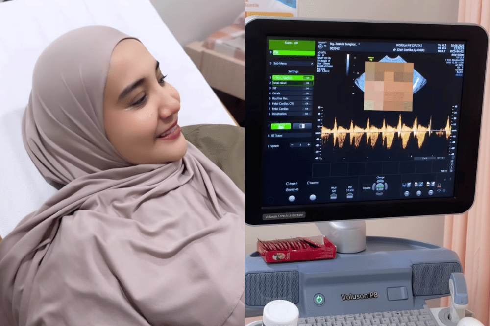 Zaskia Sungkar Makan Mangga Muda Jam 1 Malam 1.png