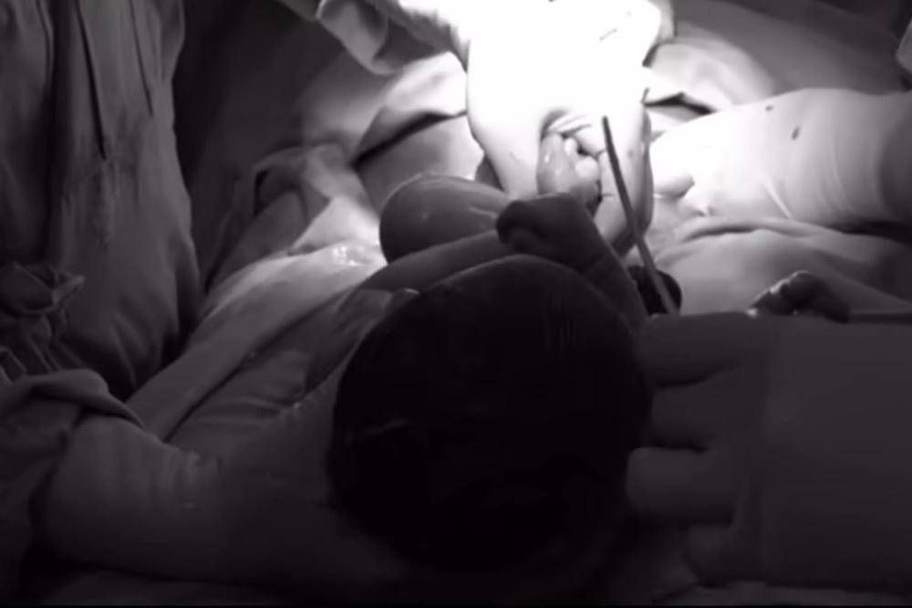 Kimmy Jayanti Haru dan Takjub Saksikan Proses Operasi Caesar Dirinya.jpg