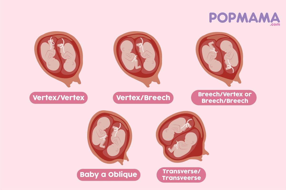 Popmama.com/Aristika Medinasari