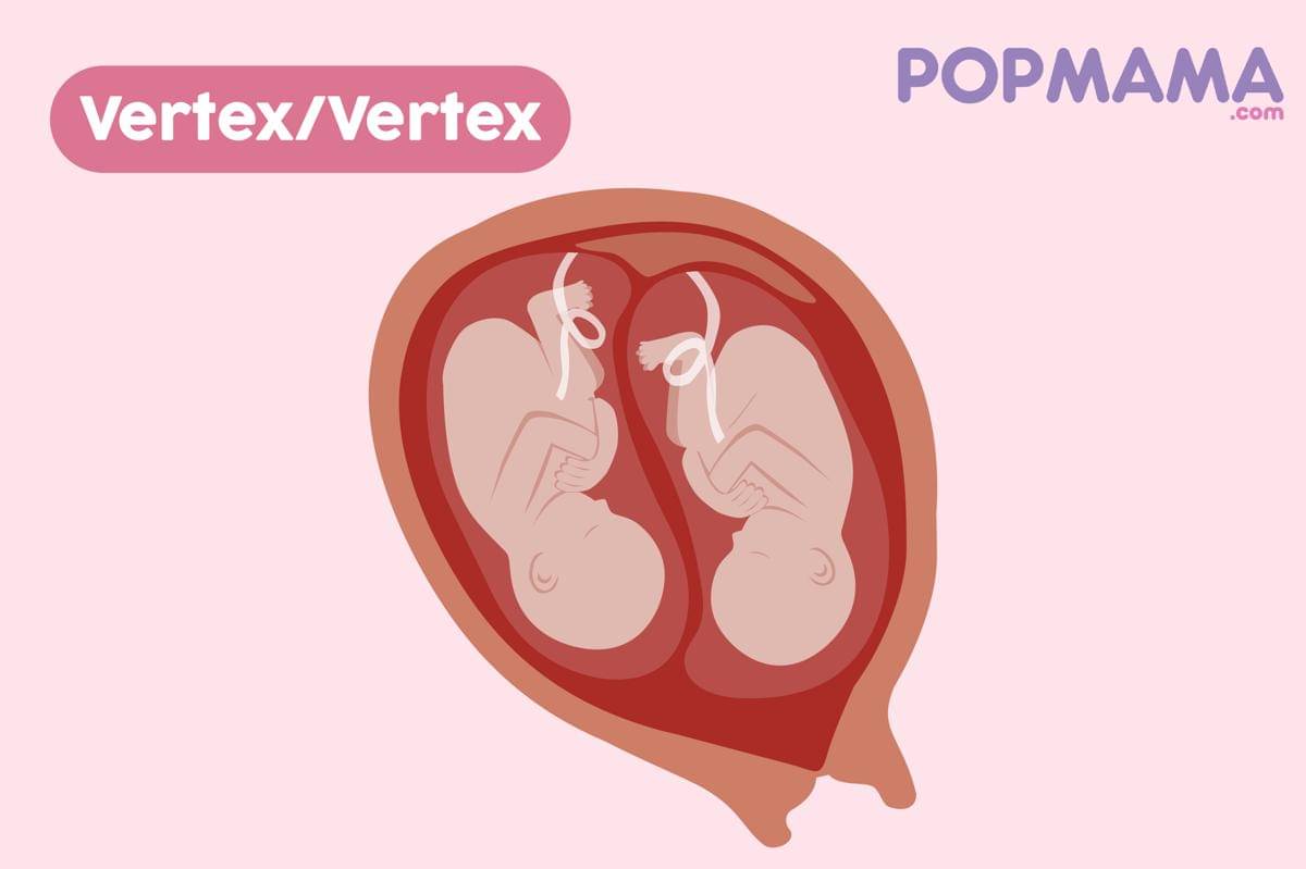 Popmama.com/Aristika Medinasari