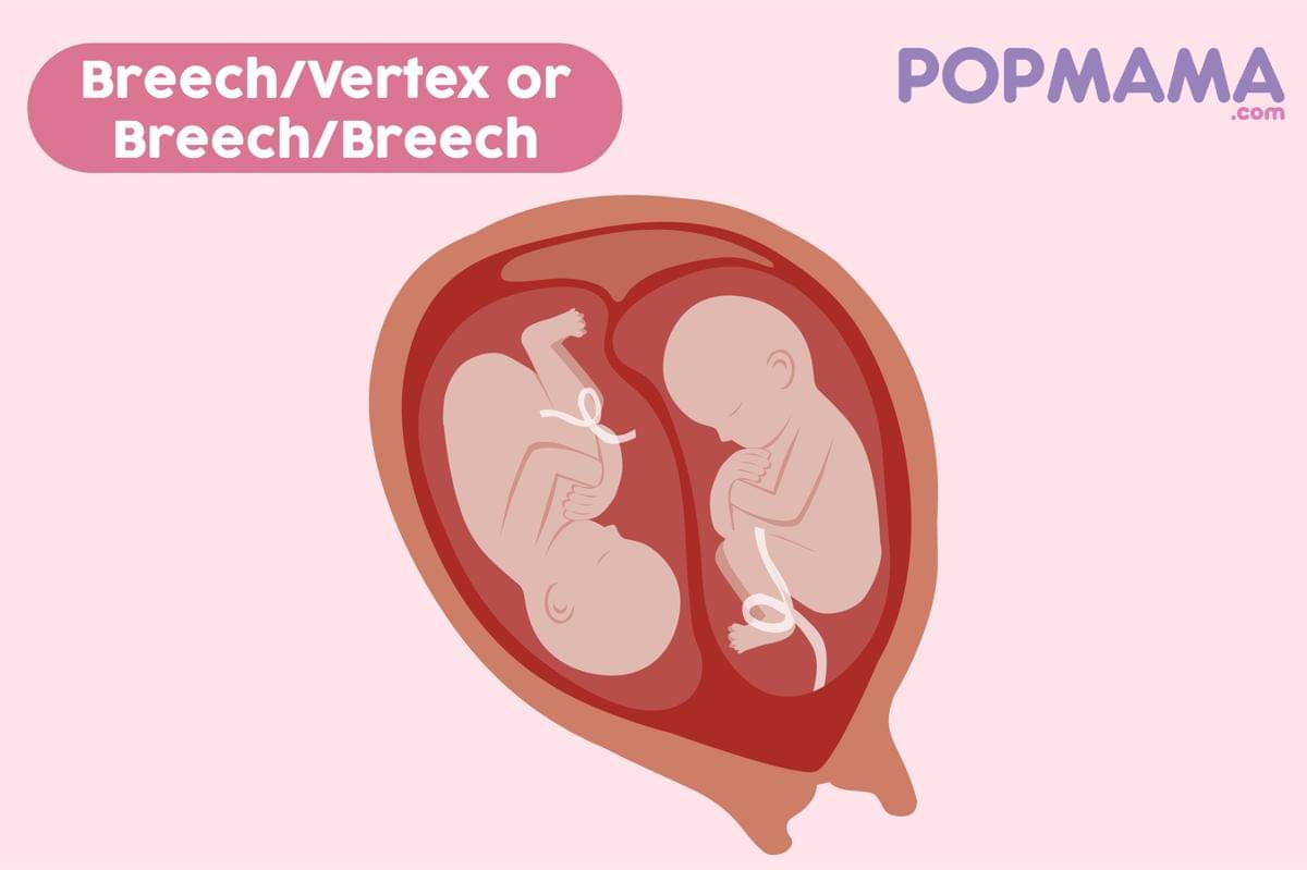 Fetal Positions-03.jpg