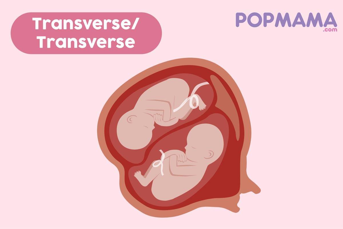 Fetal Positions-05.jpg