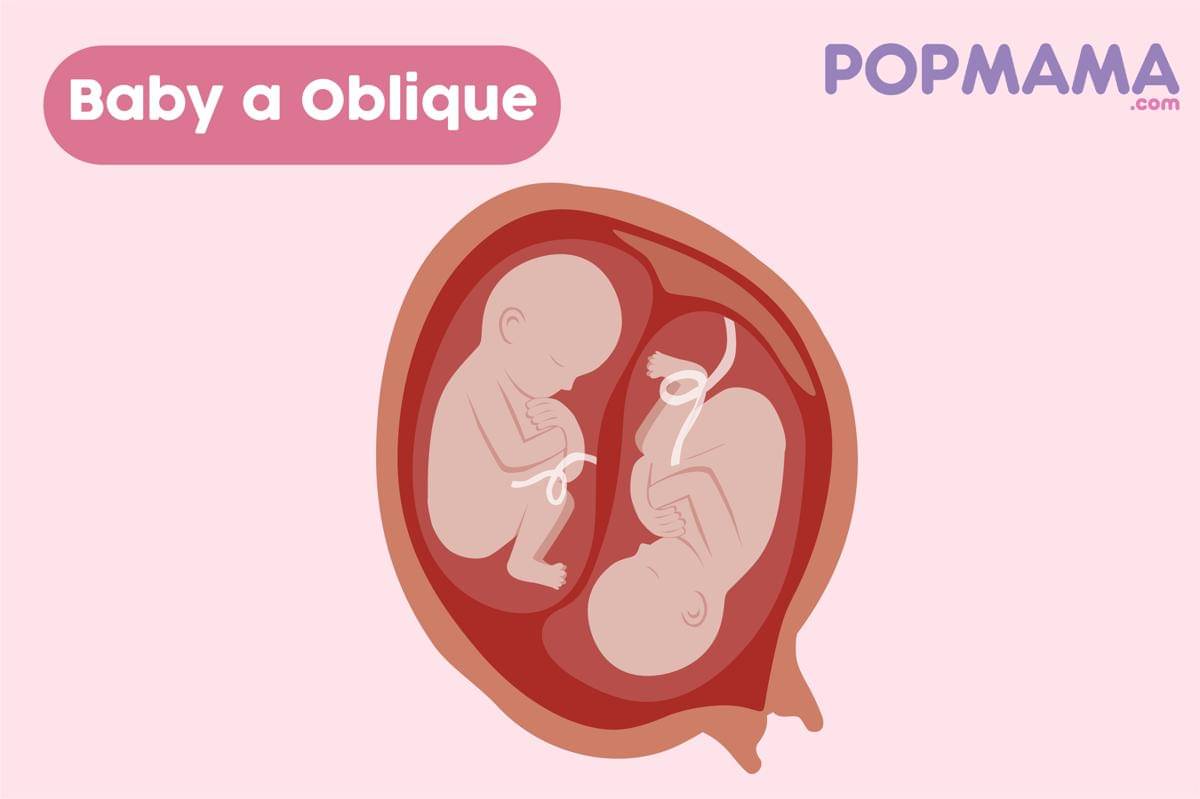 Fetal Positions-04.jpg