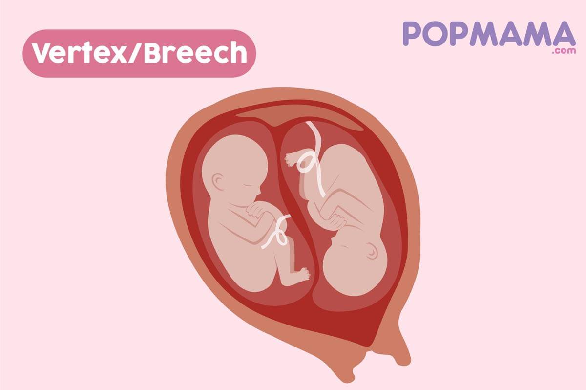 Fetal Positions-02.jpg