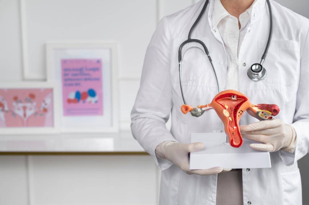 Peran Pola Makan dan Gaya Hidup dalam mengelola PCOS.jpg