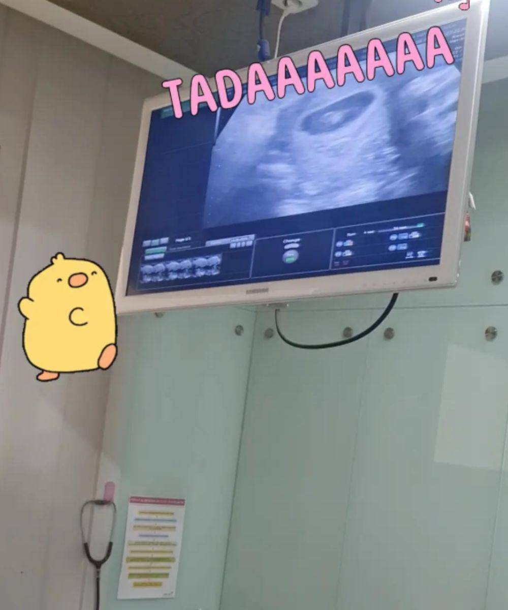 Viral di Medsos, Ibu Divonis Susah Punya Anak Namun Berhasil Hamil (1).jpg