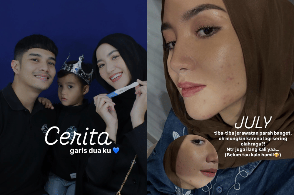 Hamil Anak Kedua, Erica Putri Mengaku Bahagia Sekaligus Deg-degan 2.png