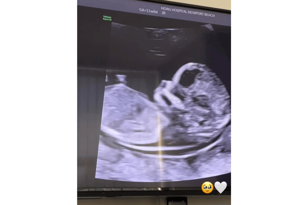 Instagram.com/aurelie