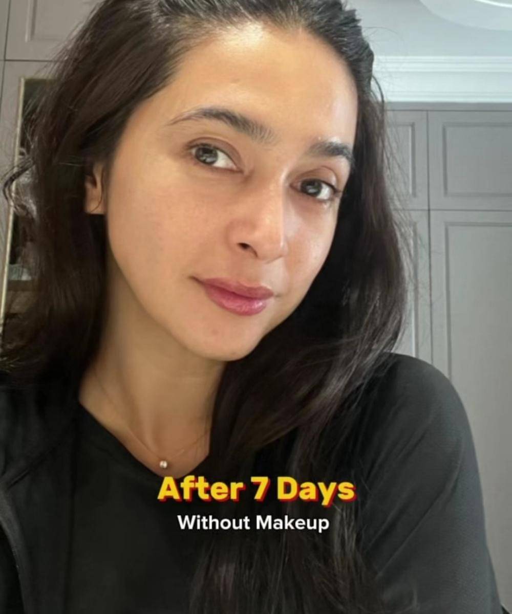 Potret Nabila Syakieb Jalani Perawatan Anti Aging di Korea   (5).jpg