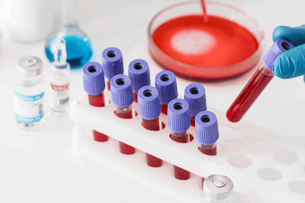 Penelitian Ungkap Golongan Darah Tertentu Berisiko Kena Stroke Dini 7.png