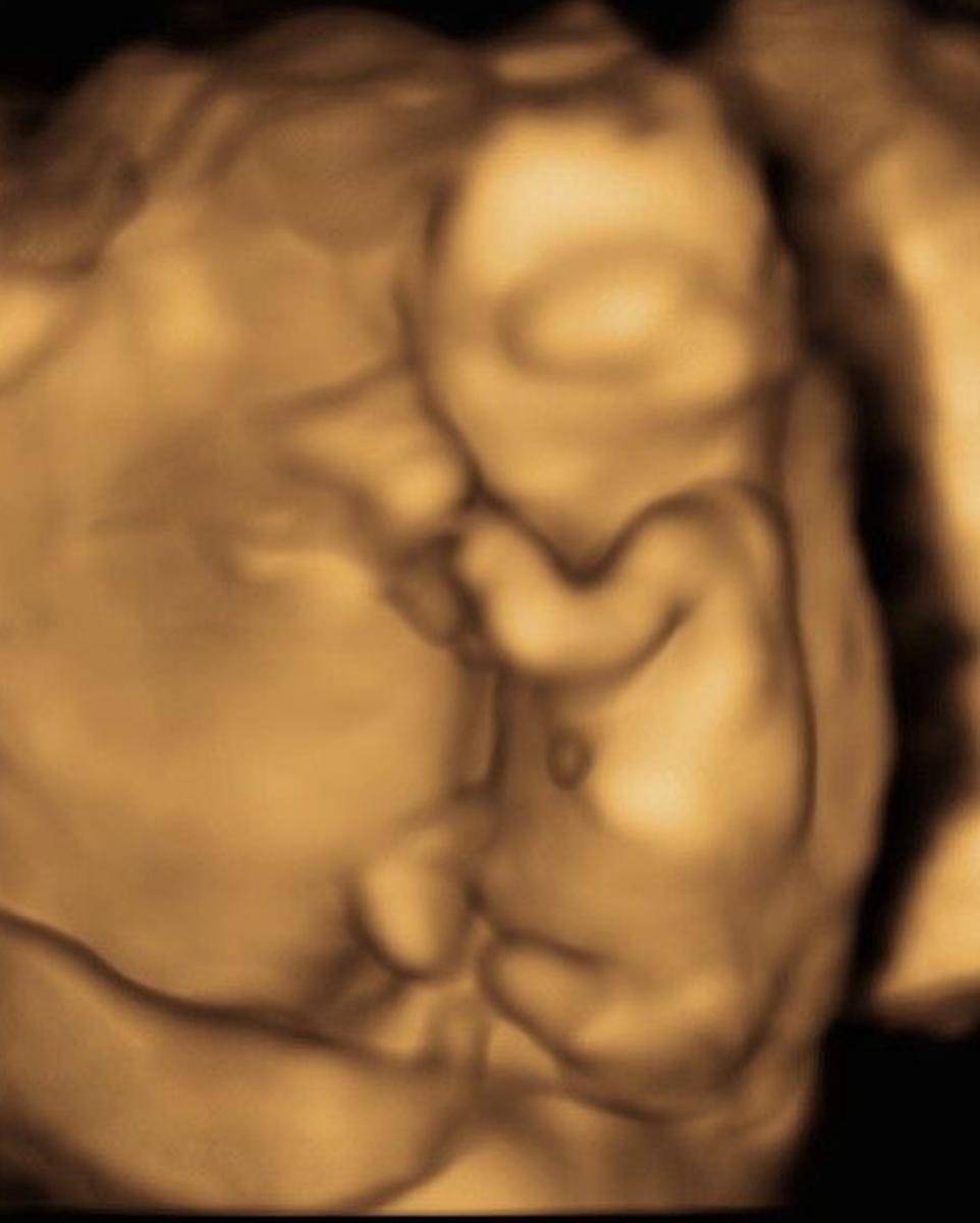 Instagram.com/putrihabibie