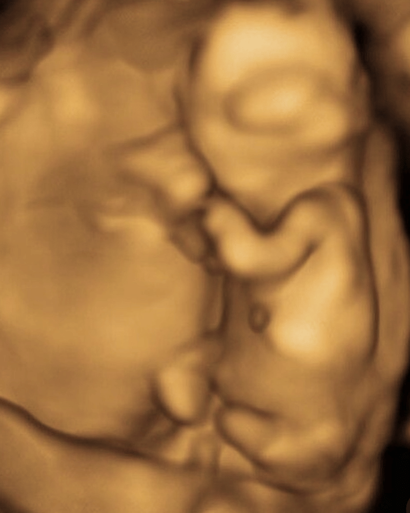 Instagram.com/putrihabibie