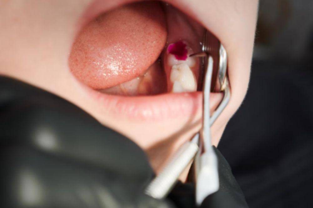 anak kekurangan vitamin dan mineral