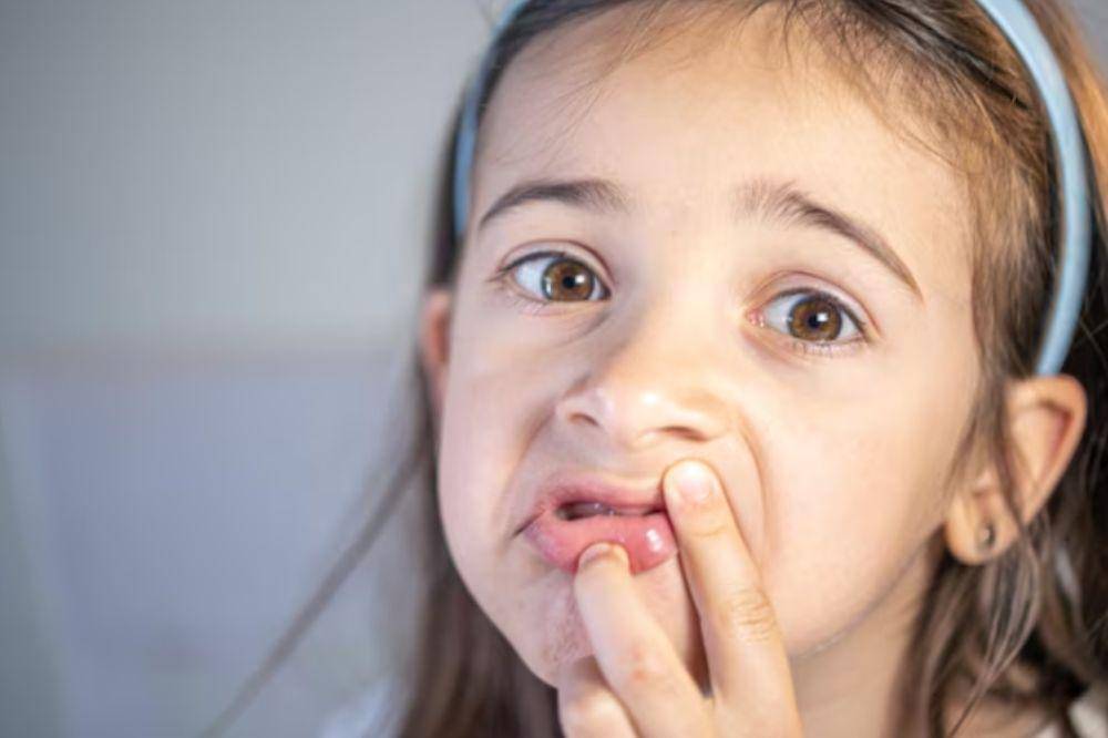 anak kekurangan vitamin dan mineral