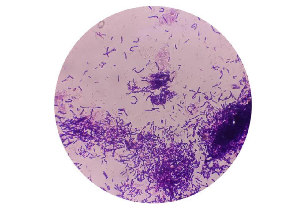 Kuas Make Up Mengandung Banyak Bakteri, Berbahaya bagi Kesehatan