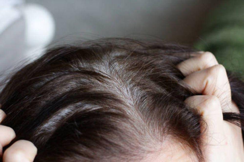 7 Alasan Rambut Uban Tidak Boleh Dicabut, Menurut Dokter! Perhatikan!