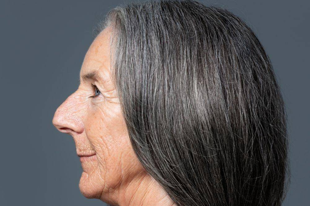 7 Alasan Rambut Uban Tidak Boleh Dicabut, Menurut Dokter! Perhatikan!