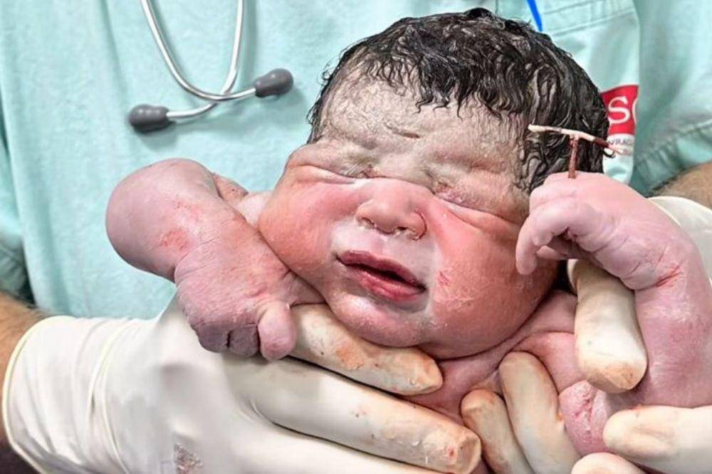 Heboh! Saat Proses Persalinan, Bayi Ini Lahir Pegang IUD sang Mama