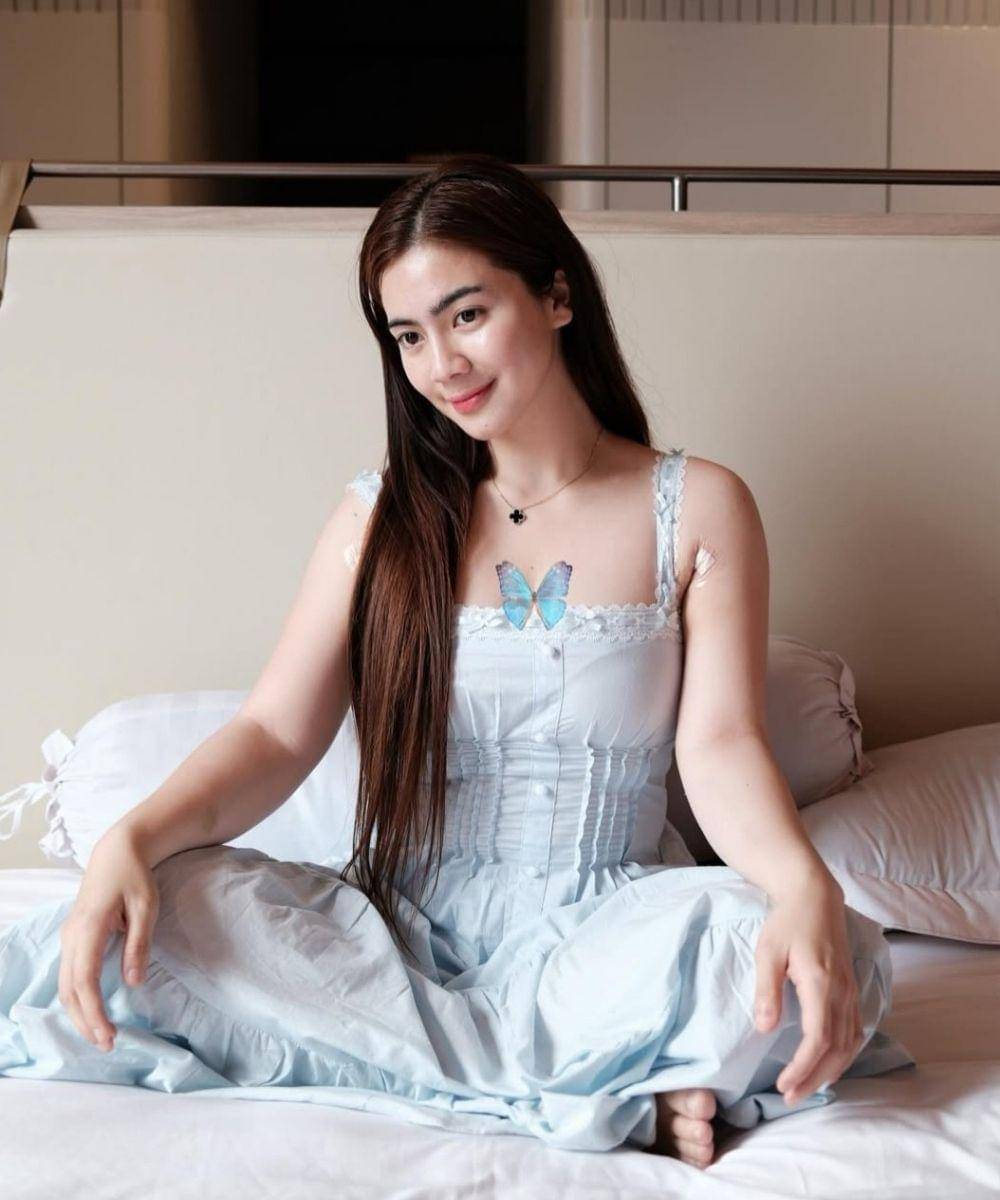 Penampilan Felicya Angelista setelah Sedot Lemak, Makin Memesona! (1).jpg