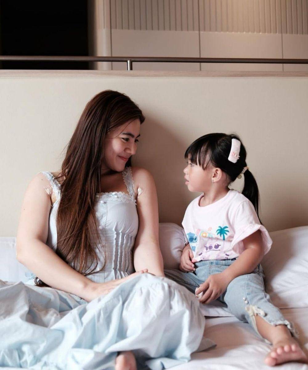 Penampilan Felicya Angelista setelah Sedot Lemak, Makin Memesona! (3).jpg