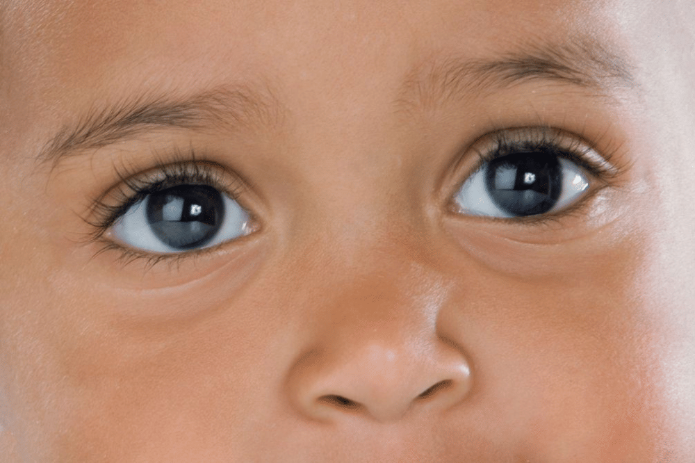 mata anak yang bergerak cepat