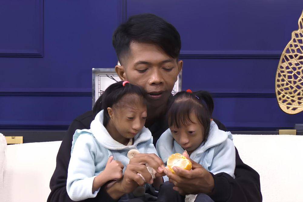 Fakta Keluarga Nabila dan Sabila yang Punya Penyakit Langka