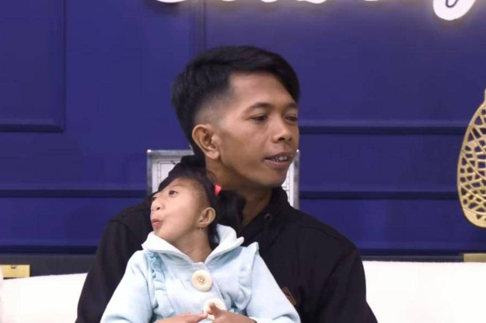 Fakta Keluarga Nabila dan Sabila yang Punya Penyakit Langka