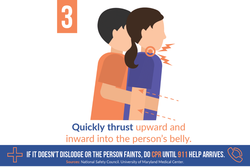 Step ketiga dalam melakukan Heimlich Maneuver