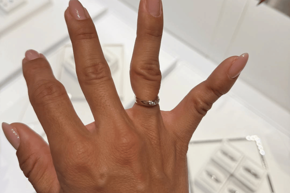 Jennifer Bachdim Alami Jari Terjepit Pintu, Cincinnya Harus Dipotong